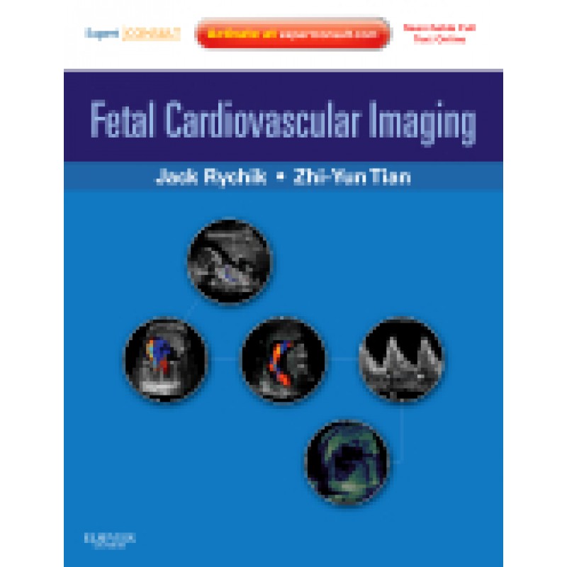 Fetal Cardiovascular Imaging: A Disease Based Approach